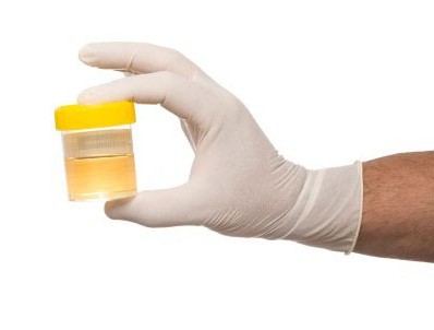 urine analysis according to Nechyporenko how to collect