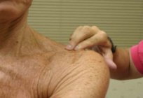 La osteoartritis de la articulación del hombro: tratamiento, síntomas y causas de la aparición de