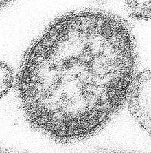 el virus del sarampión microbiología