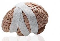 Conmoción cerebral: ¿qué hacer para ayudar al enfermo?