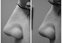 The influence of the shape of the nose on a person's character