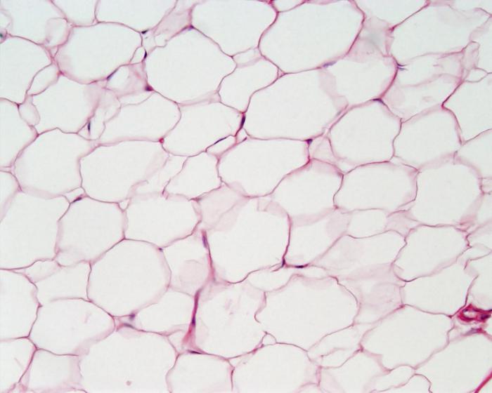 tipos de tecido epitelial