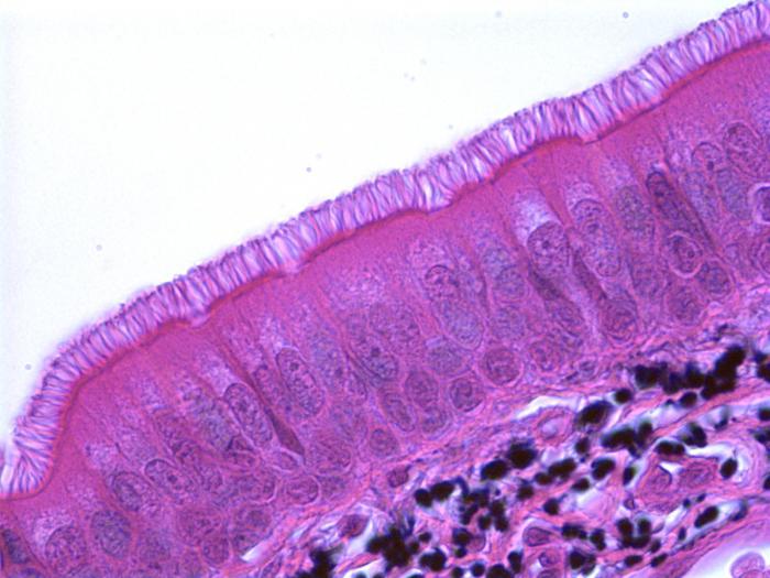  variedades de tecido epitelial