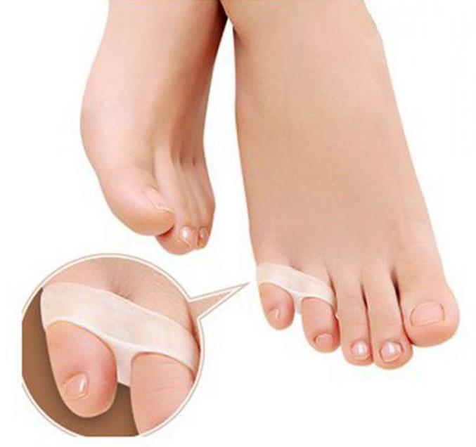 коректори для стопи і пальців ніг