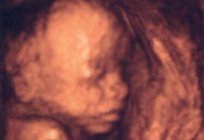 Determining the sex of the child by ultrasound, how accurate is it