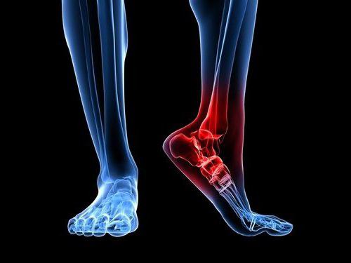 reactive synovitis of the ankle joint
