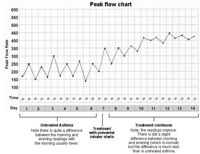 Peak Flow Meter Algorithmus