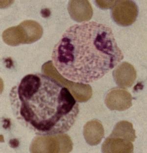 Eosinophils in the blood