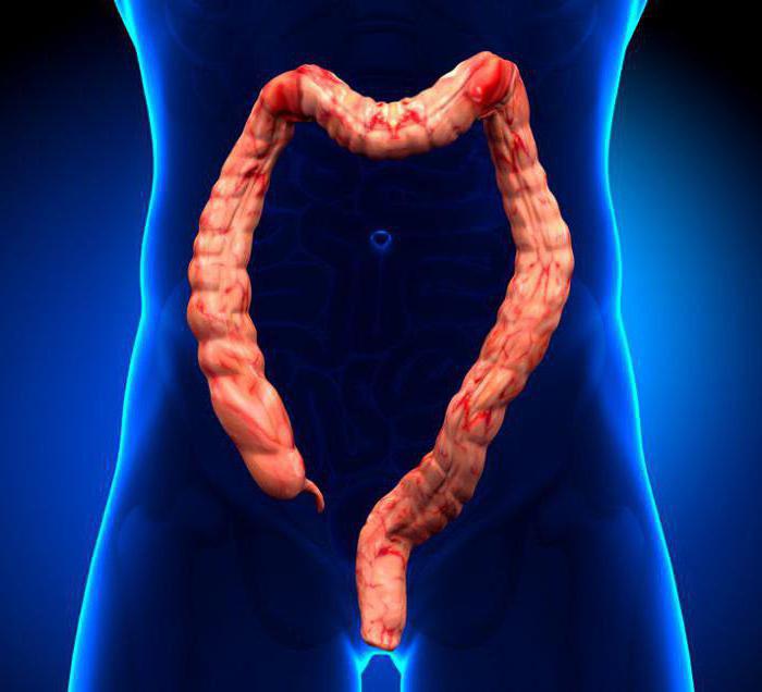 dinâmica de obstrução intestinal