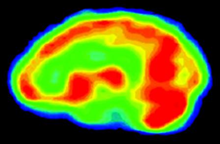 пет дослідження головного мозку