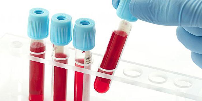 die Methodik der Bluttest auf HPV bei Frauen und Männern