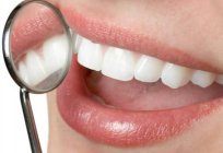 Wie viel kostet fügen Sie Ihre Zähne? Zahnimplantate – eine Alternative Möglichkeit wieder zu seiner früheren Schönheit lächeln