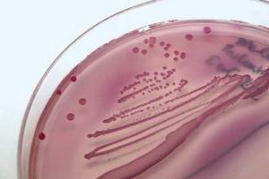 escherichia coli емдеу