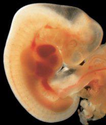Intrauterine development of the child
