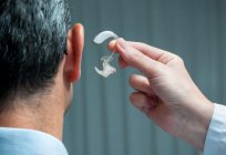 فقدان السمع الحسي العصبي: مراحل والأعراض والعلاج