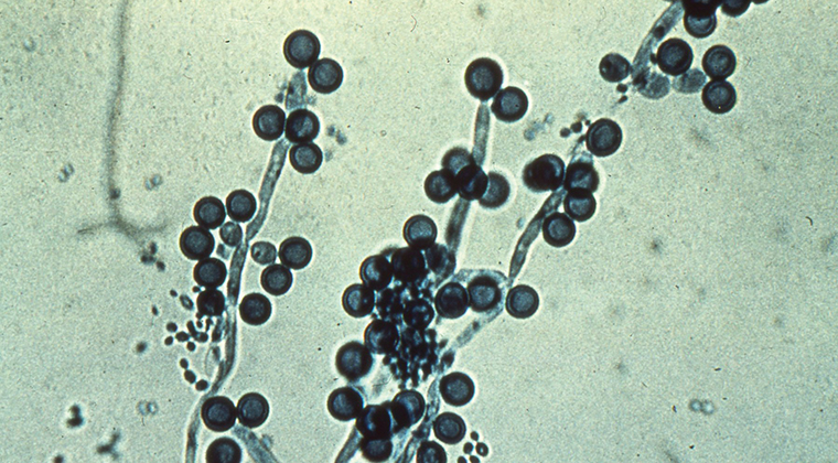 Pilze der Gattung Candida