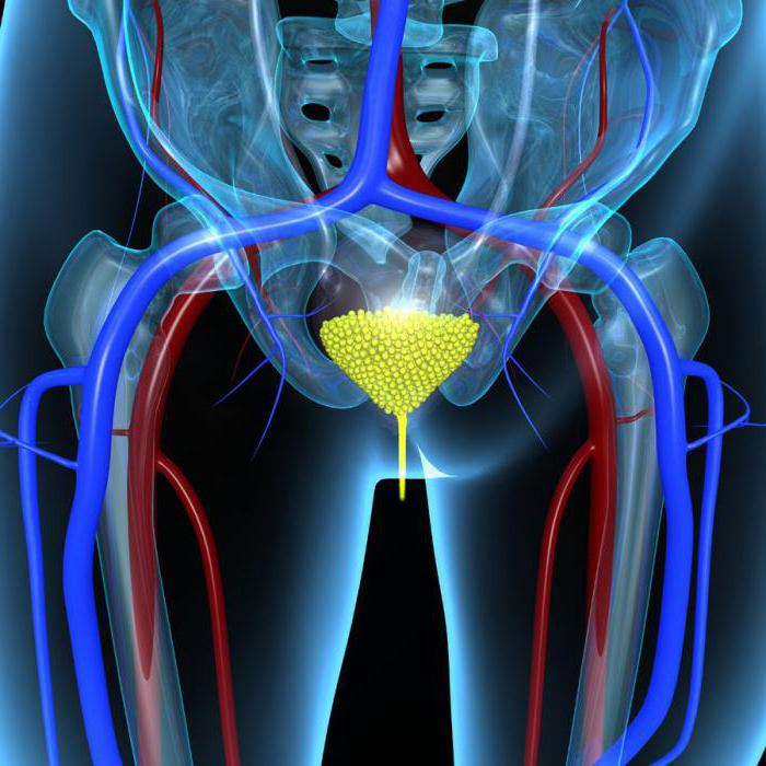 bladder cancer in men survival basic methods