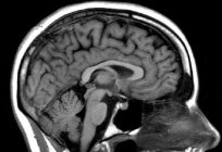 CTスキャンやMRIを得ることができ、どのような相違がありますか？