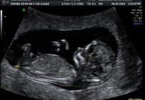 Ultrasound during pregnancy: a percentile is it important?