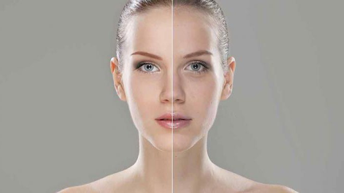 the use of botulinum toxin in cosmetology