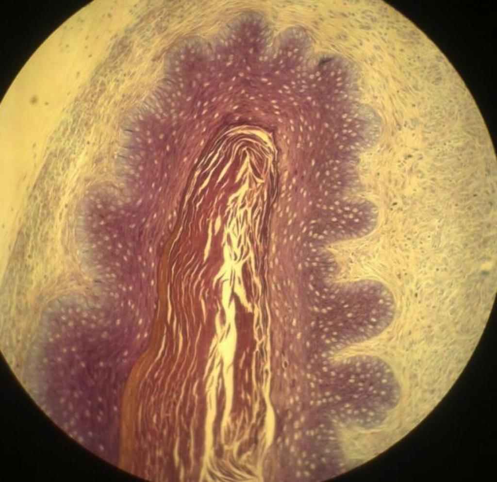 gardnerelly begleitet unter dem Mikroskop