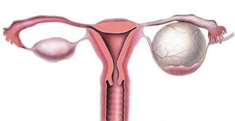 what appears cyst in women