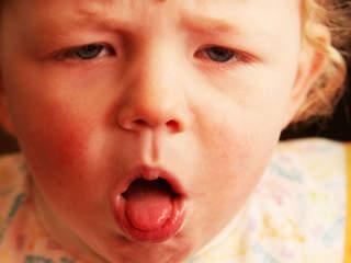obstructive bronchitis is common in a child