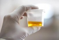 Urine formation: stages of the process, the role of the kidneys