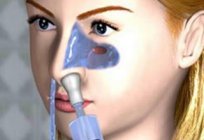 Espirros durante a gravidez: possíveis causas e características do tratamento