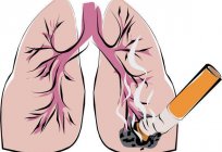 Dor no peito ao tossir: possíveis causas