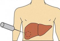 検査、肝臓:リストの方法