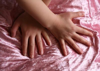 parmaklar облазит deri nedenleri