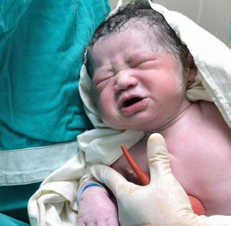 المحكمة الخبرة الطبية من جثة طفل حديث الولادة