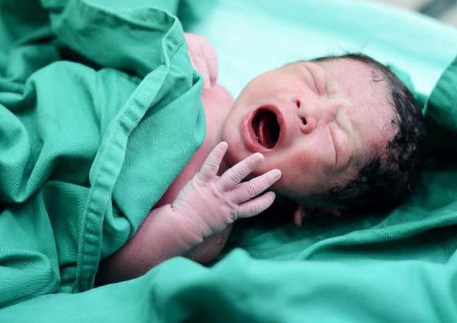 o exame de um cadáver de um bebê recém-nascido