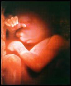 19 weeks gestation fetal location