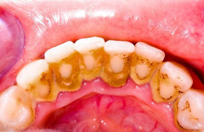 problemy z zębami u dzieci