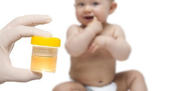 Collecting urine from newborns