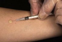 如何经常做皮肤试验的孩子？ 疫苗接种计划对于儿童在俄罗斯