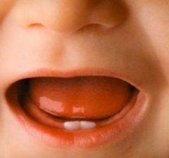 symptoms of teething in children