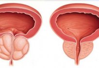 Репродуктивна система людини: захворювання. Репродуктивна система жінки. Вплив алкоголю на репродуктивну систему чоловіків