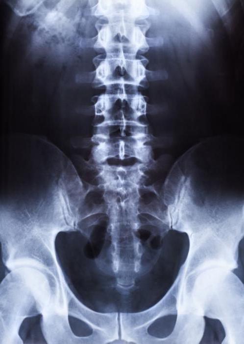 an x-ray picture