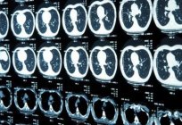 O que significa ressonância magnética na medicina?
