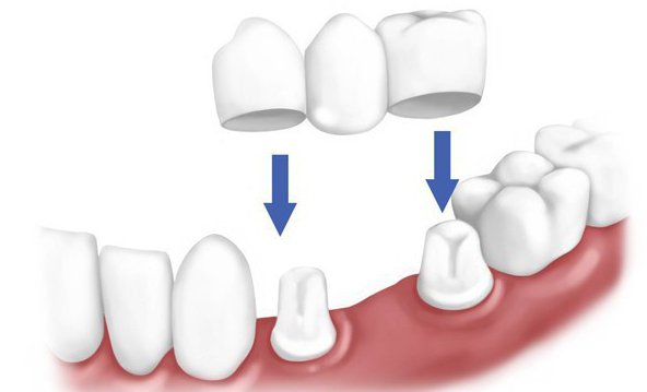 o trabalho do médico dentista ортопедом