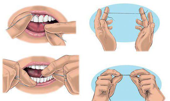 如何刷你的牙齿的牙线