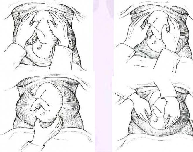 oblique position of the fetus