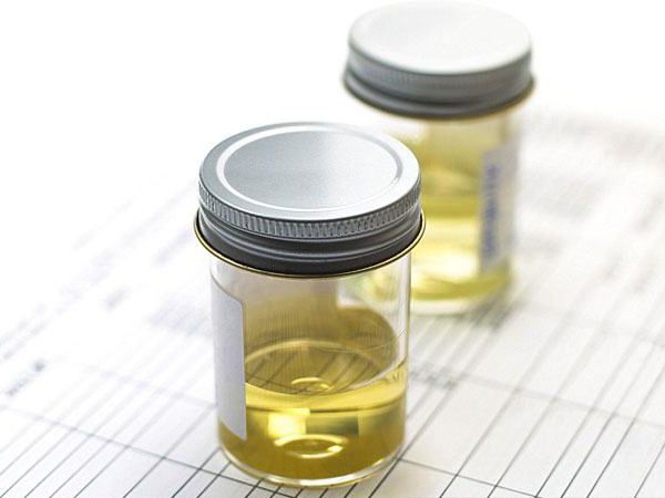 diet in the presence of oxalates in the urine