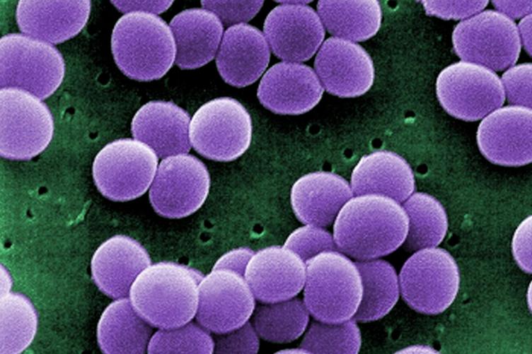 staphylococcus aureus boğaz ağrısı tedavisi yetişkinlerde