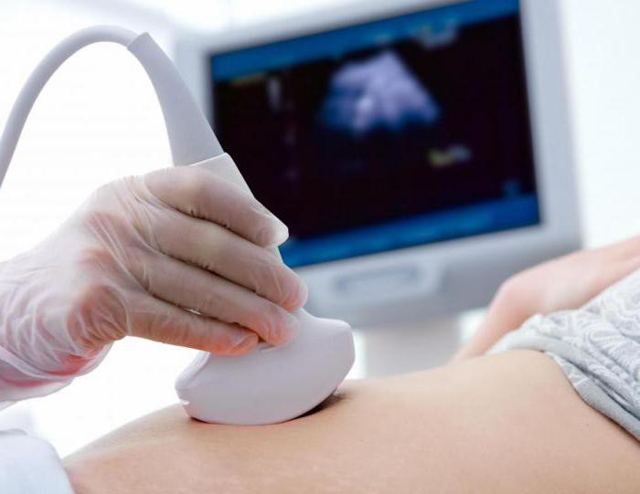 Ultraschalluntersuchung der Speiseröhre und des Magens