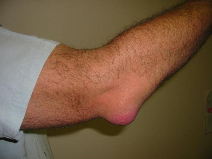 the liquid in the elbow joint