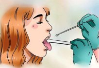 Sore tonsils. Tonsil cancer: prognosis and treatment